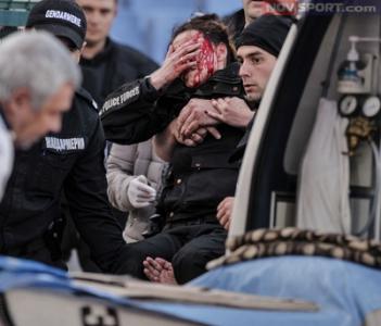 ИЗВЪНРЕДНО: Оперираха успешно ранената в дербито полицайка